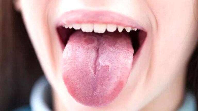 Tongue reveals health: जीभ देती है बीमारियों के संकेत,इसे हल्के में लेना पड़ सकता है भारी, जानें कैसे
