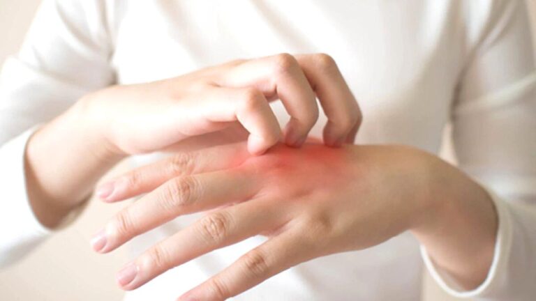 Fungal infection को हल्के में लेना हो सकता है जानलेवा! जानें क्या है स्टडी