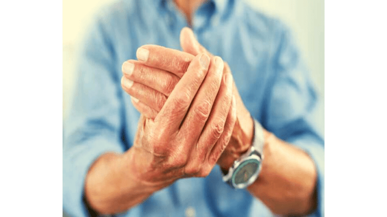 Arthritis: सावधान!अगर आपके शरीर में भी दिख रहें ये लक्षण,तो आप भी हो सकते हैं गठिया के शिकार