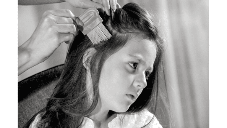 Lice Treatment:दिन-भर सिर खुजलाने रहते हैं बच्चे,तो रातों रात जुओं से छुटकारा दिलाएगा ये घरेलू नुस्खा