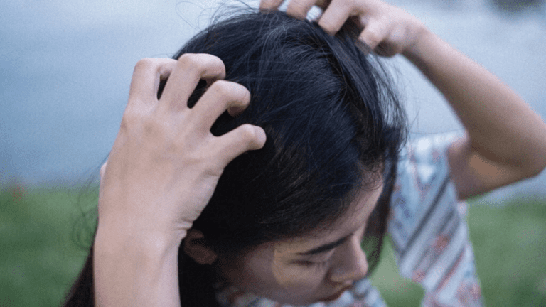 Itchy Scalp : बालों को खुजला खुजला कर हो गए हैं परेशान, तो आज ही ट्राई करें ये आसान उपाय, 2 मिनट में मिलेगी निजात
