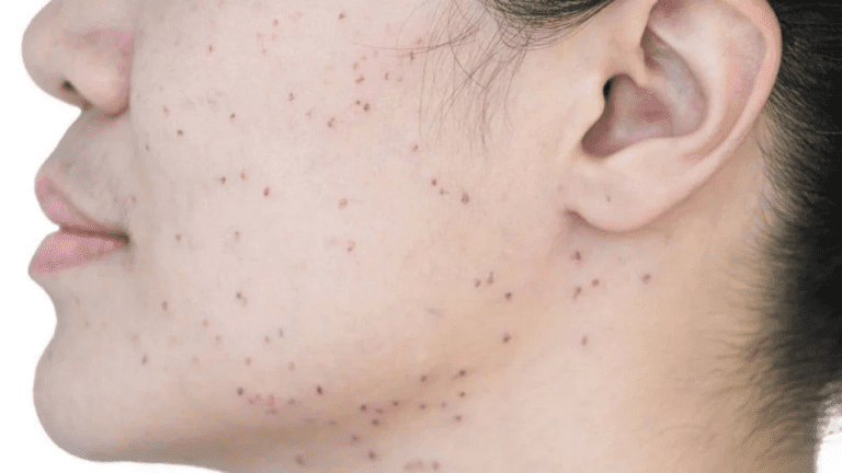 Dark Spots Removal : चेहरे पर मौजूद अनचाहे दाग धब्बों से हो गए हैं परेशान तो हल्दी का ऐसे करें इस्तेमाल, मिलेगा फायदा