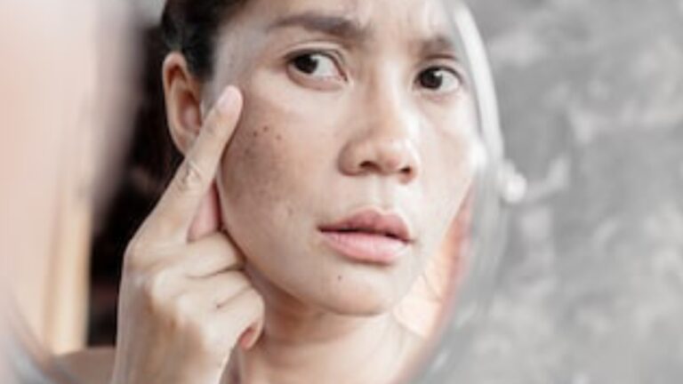 Pigmentation Problem:कुछ ही दिनों में चेहरे की झाइयां हो जाएगी उड़नछू,छुटकारा दिलाएंगे ये घरेलू उपाय