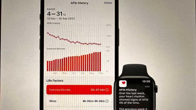 Afib history feature: एप्पल वॉच यूजर्स के लिए लॉन्च हुआ नया फीचर, जानें कैसे कर सकते हैं ऑन