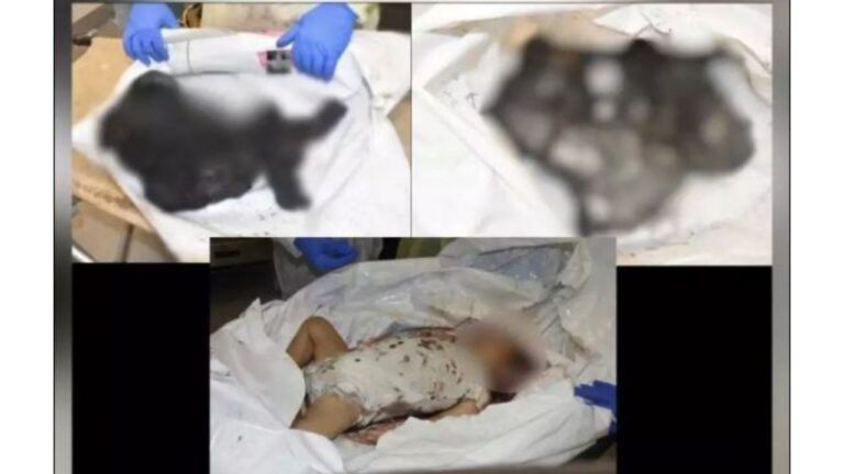 Israel Attack: हमास ने छोटे बच्चों की हत्या करने के बाद जलाए उनके शव -बेंजामिन नेतन्याहू 