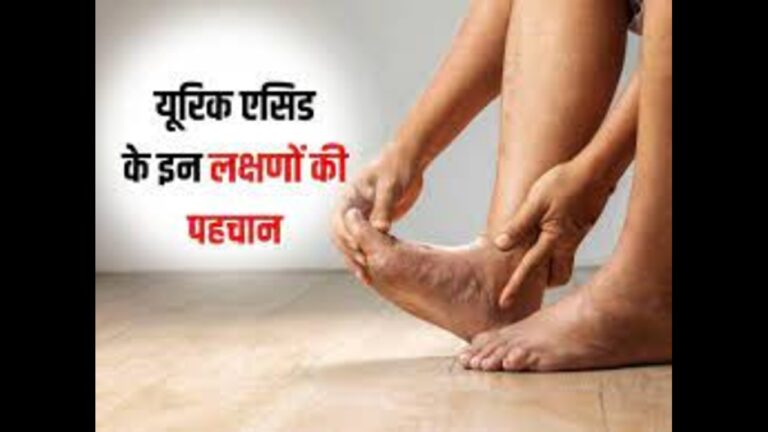 कई गंभीर बीमारियों को साथ लाता है यूरिक एसिड, जानें लक्षण और बचाव के उपाय 