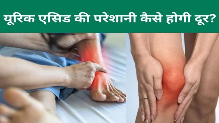 बढ़ रहा यूरिक एसिड तो हो जाएं सावधान वरना ये बीमारियां बन जाएंगी मुसीबत, जानें लक्षण और उपाय